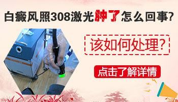 小儿颈部皮肤白斑